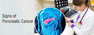 SIGNS OF PANCREATIC CANCER YOU SHOULD NEVER, EVER IGNORE