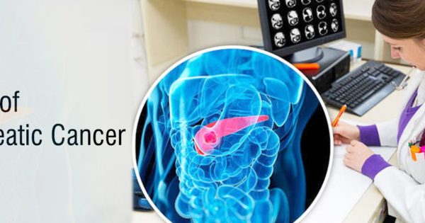 SIGNS OF PANCREATIC CANCER YOU SHOULD NEVER, EVER IGNORE - BEST MINERAL ...